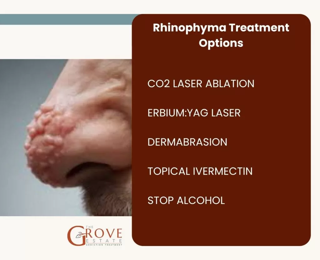Rhinophyma treatment options